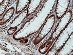 FES Antibody in Immunohistochemistry (Paraffin) (IHC (P))