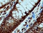 FES Antibody in Immunohistochemistry (Paraffin) (IHC (P))