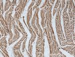 ASK1 Antibody in Immunohistochemistry (Paraffin) (IHC (P))