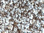 CD21 Antibody in Immunohistochemistry (Paraffin) (IHC (P))