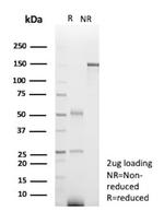 Glucose 6-Phosphate Isomerase Antibody in SDS-PAGE (SDS-PAGE)