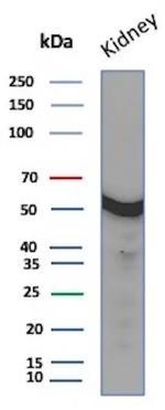 Glucose 6-Phosphate Isomerase Antibody in Western Blot (WB)