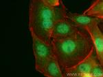 RAI2 Antibody in Immunocytochemistry (ICC/IF)