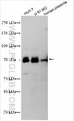 RAI2 Antibody in Western Blot (WB)