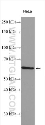 PCSK1 Antibody in Western Blot (WB)