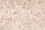 CXCR5 Antibody in Immunohistochemistry (Paraffin) (IHC (P))