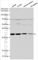 CXCR5 Antibody in Western Blot (WB)
