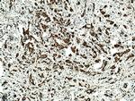GLI2 Antibody in Immunohistochemistry (Paraffin) (IHC (P))