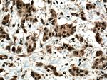 GLI2 Antibody in Immunohistochemistry (Paraffin) (IHC (P))