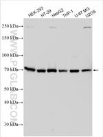 RNF139 Antibody in Western Blot (WB)
