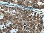 TMEM192 Antibody in Immunohistochemistry (Paraffin) (IHC (P))