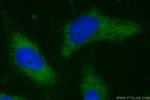 Calmodulin 1/2/3 Antibody in Immunocytochemistry (ICC/IF)