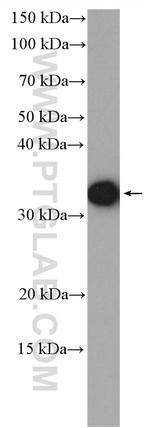 PTPRCAP Antibody in Western Blot (WB)