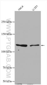 IPO7 Antibody in Western Blot (WB)