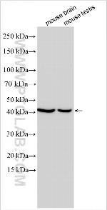 FOXJ2 Antibody in Western Blot (WB)