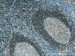 CD180 Antibody in Immunohistochemistry (Paraffin) (IHC (P))