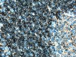 CD180 Antibody in Immunohistochemistry (Paraffin) (IHC (P))