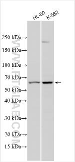 RBM48 Antibody in Western Blot (WB)