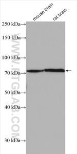 EOMES/TBR2 Antibody in Western Blot (WB)