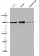 PDS5B Antibody in Western Blot (WB)