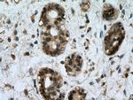 UBE2D1/2/3/4 Antibody in Immunohistochemistry (Paraffin) (IHC (P))