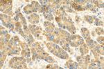 RALGAPB Antibody in Immunohistochemistry (Paraffin) (IHC (P))