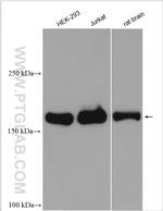 RALGAPB Antibody in Western Blot (WB)