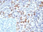 CD163L1 Monoclonal Antibody (CD163L1/7974)