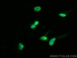 HDAC9 Antibody in Immunocytochemistry (ICC/IF)