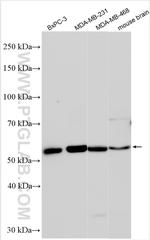 HDAC9 Antibody in Western Blot (WB)