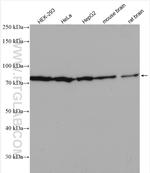 MFN2 Antibody in Western Blot (WB)