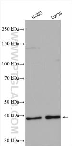 MTBP Antibody in Western Blot (WB)