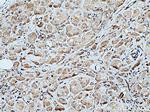 WNK1 Antibody in Immunohistochemistry (Paraffin) (IHC (P))