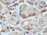 WNK1 Antibody in Immunohistochemistry (Paraffin) (IHC (P))