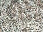BOP1 Antibody in Immunohistochemistry (Paraffin) (IHC (P))