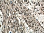 BOP1 Antibody in Immunohistochemistry (Paraffin) (IHC (P))