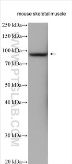 COMP Antibody in Western Blot (WB)
