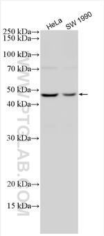 AURKA Antibody in Western Blot (WB)