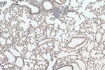 Integrin beta-6 Antibody in Immunohistochemistry (Paraffin) (IHC (P))