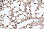 Integrin beta-6 Antibody in Immunohistochemistry (Paraffin) (IHC (P))