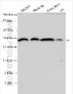CYP19A1 Antibody in Western Blot (WB)