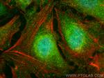 KAT2A/GCN5 Antibody in Immunocytochemistry (ICC/IF)