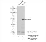 KAT2A/GCN5 Antibody in Immunoprecipitation (IP)