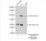 KAT2A/GCN5 Antibody in Immunoprecipitation (IP)