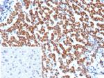 Angiopoietin/ANGPT1 Monoclonal Antibody (ANGPT1/3651)