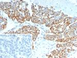 Angiopoietin/ANGPT1 Antibody in Immunohistochemistry (Paraffin) (IHC (P))