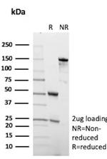 Angiopoietin/ANGPT1 Antibody in SDS-PAGE (SDS-PAGE)