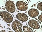 MSTO1 Antibody in Immunohistochemistry (Paraffin) (IHC (P))