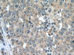 SEMA4C Antibody in Immunohistochemistry (Paraffin) (IHC (P))