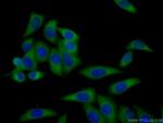 ARHGAP18 Antibody in Immunocytochemistry (ICC/IF)